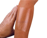 Mepitel Film Dressing
