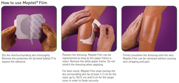 Mepitel Film Dressing