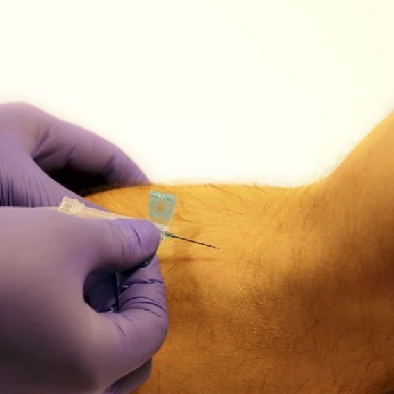 WINGED INFUSION SET