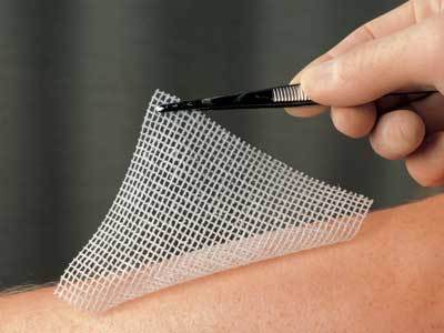 JELONET* PARAFFIN GAUZE DRESSING 10CM X 10CM X 1