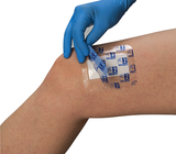 Film Dressing, Transparent Film Dressing, Waterproof Film Dressing, Waterproof Wound Film Dressing, Claripose Wound Care Dressings, Claripose, Wound Dressing, Penrith Wound Dressings, Island Wound Dressing, Adhesive Dressing
