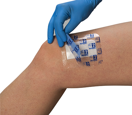 Film Dressing, Transparent Film Dressing, Waterproof Film Dressing, Waterproof Wound Film Dressing, Claripose Wound Care Dressings, Claripose, Wound Dressing, Penrith Wound Dressings, Island Wound Dressing, Adhesive Dressing