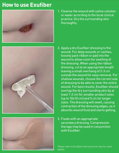 Wound Dressing, Wound Care, heavy exudate, sloughy wound, pressure ulcer, Penrith Wound Dressings, painful wound, online wound dressings, medium to high exudation, leg ulcer, high exudation, foot ulcer, Buy wound Dressings Penrith, Polyvinyl alcohol, PVA, Superabsorbent, Exufiber, Fibre dressing, Cavity wounds, hydrolock, pressure sore, diabetic foot ulcer, venous ulcer