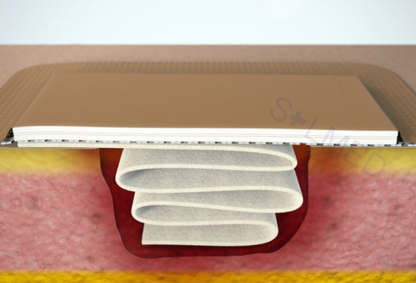 Exufiber Ag+ Silver Gelling Fibre Dressing