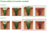 Exufiber Gel Dressing (Expired)