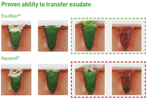 Exufiber Gel Dressing (Expired)
