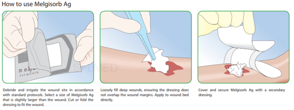 wound infection, Wound Dressing, Wound Care, viscous exudate, topical antimicrobial, sloughy wound, silver sulphate, silver dressing, pressure ulcer, Penrith Wound Dressings, painful wound, online wound dressings, Melgisorb Ag, medium to high exudation, leg ulcer, infected wound, high exudation, foot ulcer, Buy wound Dressings Penrith, Antimicrobial Dressing, Antimicrobial, Calcium Alginate, CMC fibres