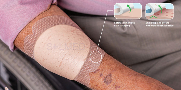 pressure ulcer, leg ulcer, foot ulcer, Absorbent wound dressing, Absorbent Pads bordered foam dressing, viscous exudate, medium to high exudation, high exudation Woundcare Foam Dressing, Wound Pad, Wound Dressing, Wound Care, Waterproof Wound Film Dressing, safetac, Penrith Wound Dressings, online wound dressings, molnlycke, mepilex, Island Woundcare Dressing, Island Wound Dressing, Foam Cushion Wound Dressings, Buy wound Dressings Penrith, Buy Waterproof Wound Dressings