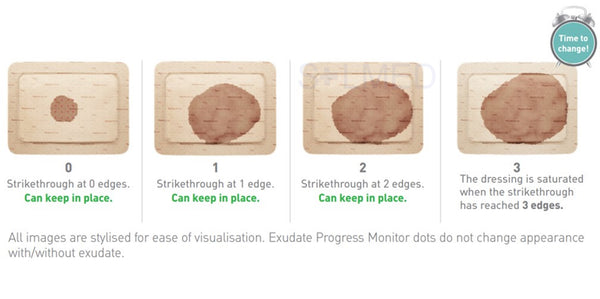 pressure ulcer, leg ulcer, foot ulcer, Absorbent wound dressing, Absorbent Pads bordered foam dressing, viscous exudate, medium to high exudation, high exudation Woundcare Foam Dressing, Wound Pad, Wound Dressing, Wound Care, Waterproof Wound Film Dressing, safetac, Penrith Wound Dressings, online wound dressings, molnlycke, mepilex, Island Woundcare Dressing, Island Wound Dressing, Foam Cushion Wound Dressings, Buy wound Dressings Penrith, Buy Waterproof Wound Dressings