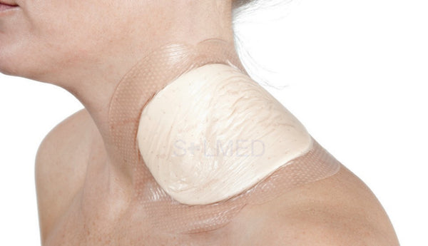 pressure ulcer, leg ulcer, foot ulcer, Absorbent wound dressing, Absorbent Pads bordered foam dressing, viscous exudate, medium to high exudation, high exudation Woundcare Foam Dressing, Wound Pad, Wound Dressing, Wound Care, Waterproof Wound Film Dressing, safetac, Penrith Wound Dressings, online wound dressings, molnlycke, mepilex, Island Woundcare Dressing, Island Wound Dressing, Foam Cushion Wound Dressings, Buy wound Dressings Penrith, Buy Waterproof Wound Dressings