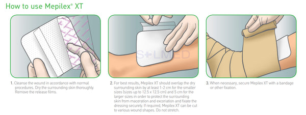 Mepilex XT Foam, Mepilex XT, Foam Dressing, Woundcare Foam Dressing, Wound Pad Wound Dressing, Wound Care, safetac, pressure ulcer, Penrith Wound Dressings, online wound dressings, molnlycke, mepilex, leg ulcer, foot ulcer, Foam Cushion Wound Dressings, Buy wound Dressings Penrith, Absorbent wound dressing, Absorbent Pads
