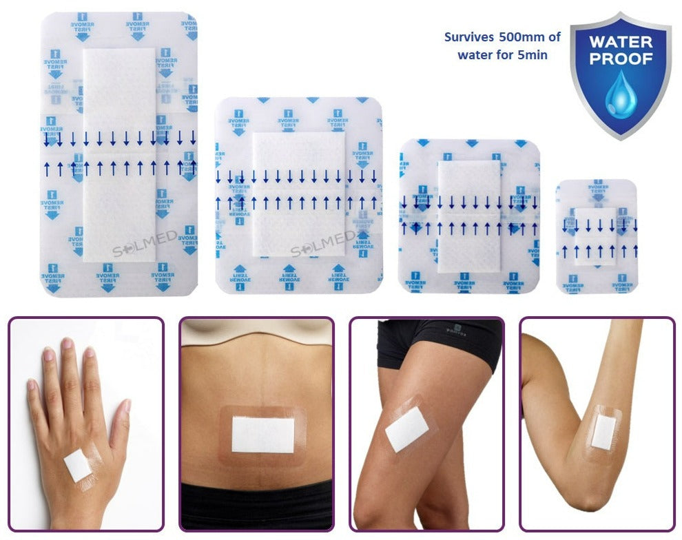 Buy Waterproof Wound Dressings | SOLMED MEDICAL SUPPLIES Solmed Medical Supplies Buy Waterproof Wound Dressings | SOLMED MEDICAL SUPPLIES Solmed Medical Supplies