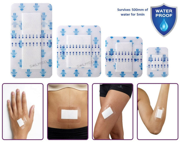 Film Dressing, Transparent Film Dressing, Waterproof Film Dressing, Waterproof Wound Film Dressing, Claripose Wound Care Dressings, Claripose, Wound Dressing, Penrith Wound Dressings, Island Wound Dressing, Adhesive Dressing