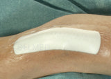 Mepilex Border Post-Op Dressing