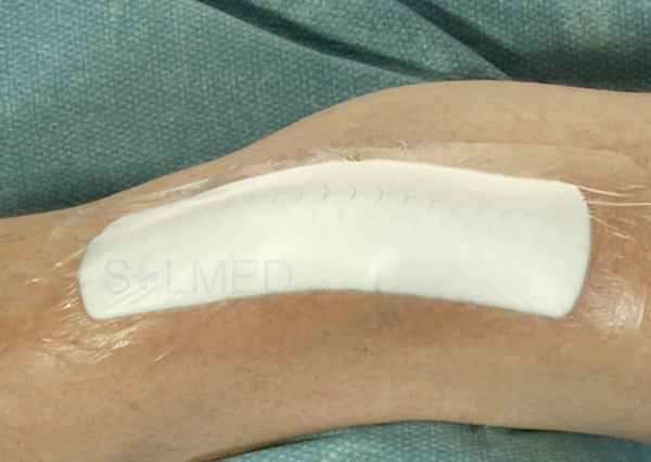 Mepilex Border Post-Op Dressing