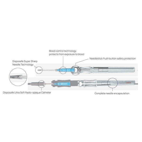 Safety IV Cannula with Blood Control