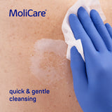 A person wearing blue gloves wipes foam from human skin, using MoliCare Skin Cleansing Foam for gentle skin care.