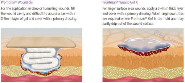 Prontosan Wound Gel X