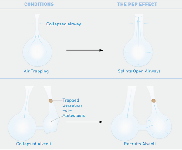 Acapella DM Vibratory PEP System