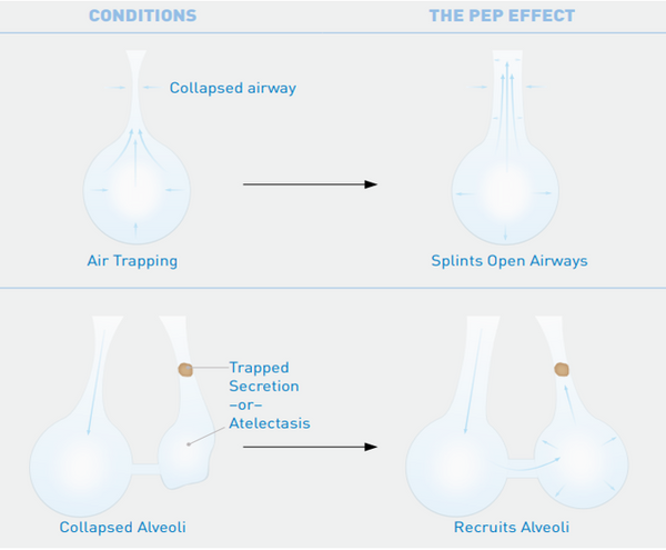 Pep Instrument Acapella Choice Vibratory PEP System | SOLMED – Solmed Medical Supplies