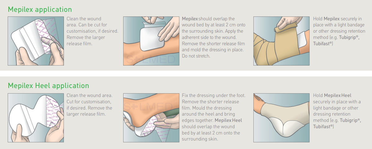 Mepilex | SOLMED MEDICAL SUPPLIES – Solmed Medical Supplies