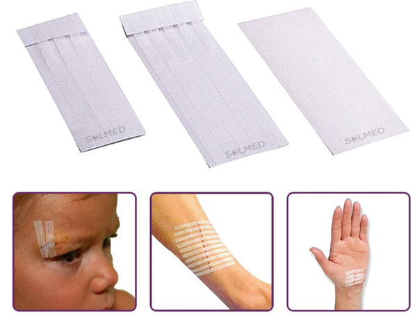 Butterfly Strips, Wound Closure, Wound Closure Strips, Skin Closure, Skin Closures, steri strips, steristrips, Wound Dressing, Penrith Wound Dressings, Adhesive Dressing