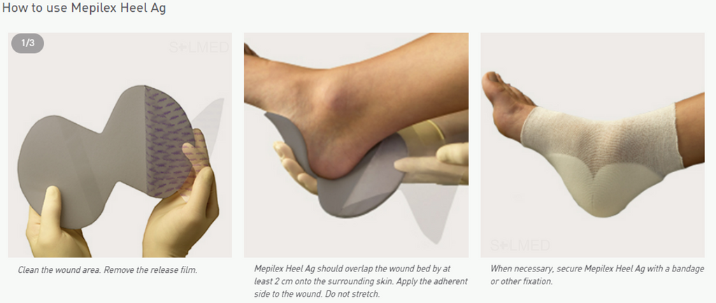 Mepilex Ag Foam Dressings | SOLMED MEDICAL SUPPLIES Solmed Medical Supplies Mepilex Ag Foam Dressings | SOLMED MEDICAL SUPPLIES Solmed Medical Supplies